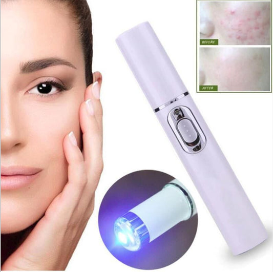 Portable Blue Light Therapy Acne Laser Pen, Wrinkle Removal Machine, Relaxing Massage Tool, Soft Scar and Dark Circles Remover Device